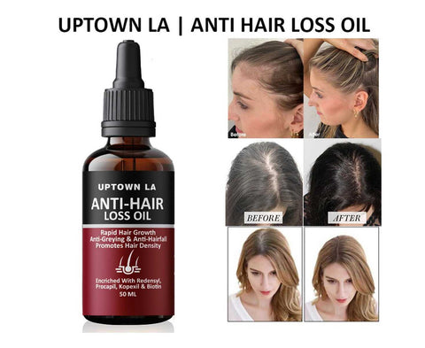 Uptown La Anti Hair Loss Hair Regrowth Oil - 30 Ml