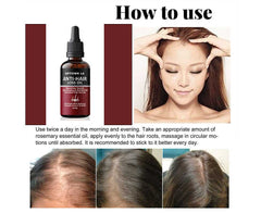 Uptown La Anti Hair Loss Hair Regrowth Oil - 30 Ml